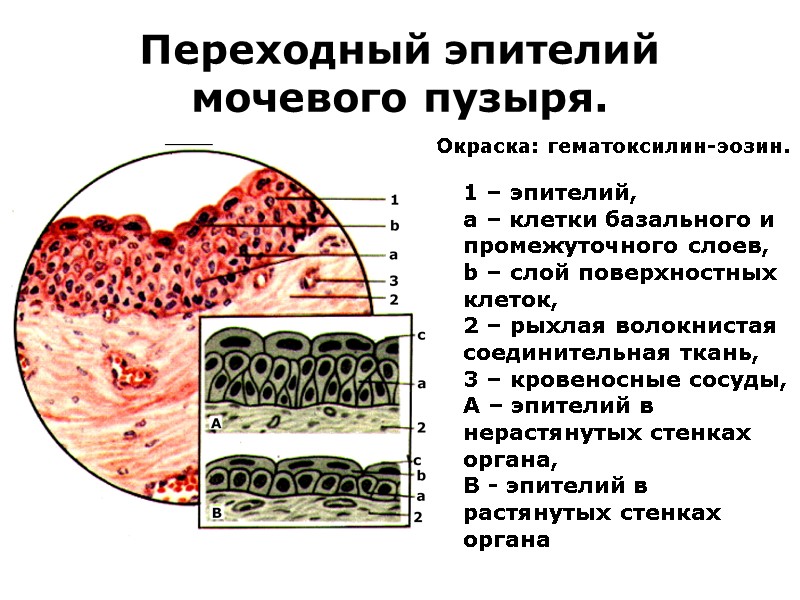 Переходный эпителий мочевого пузыря. 1 – эпителий,  a – клетки базального и промежуточного
